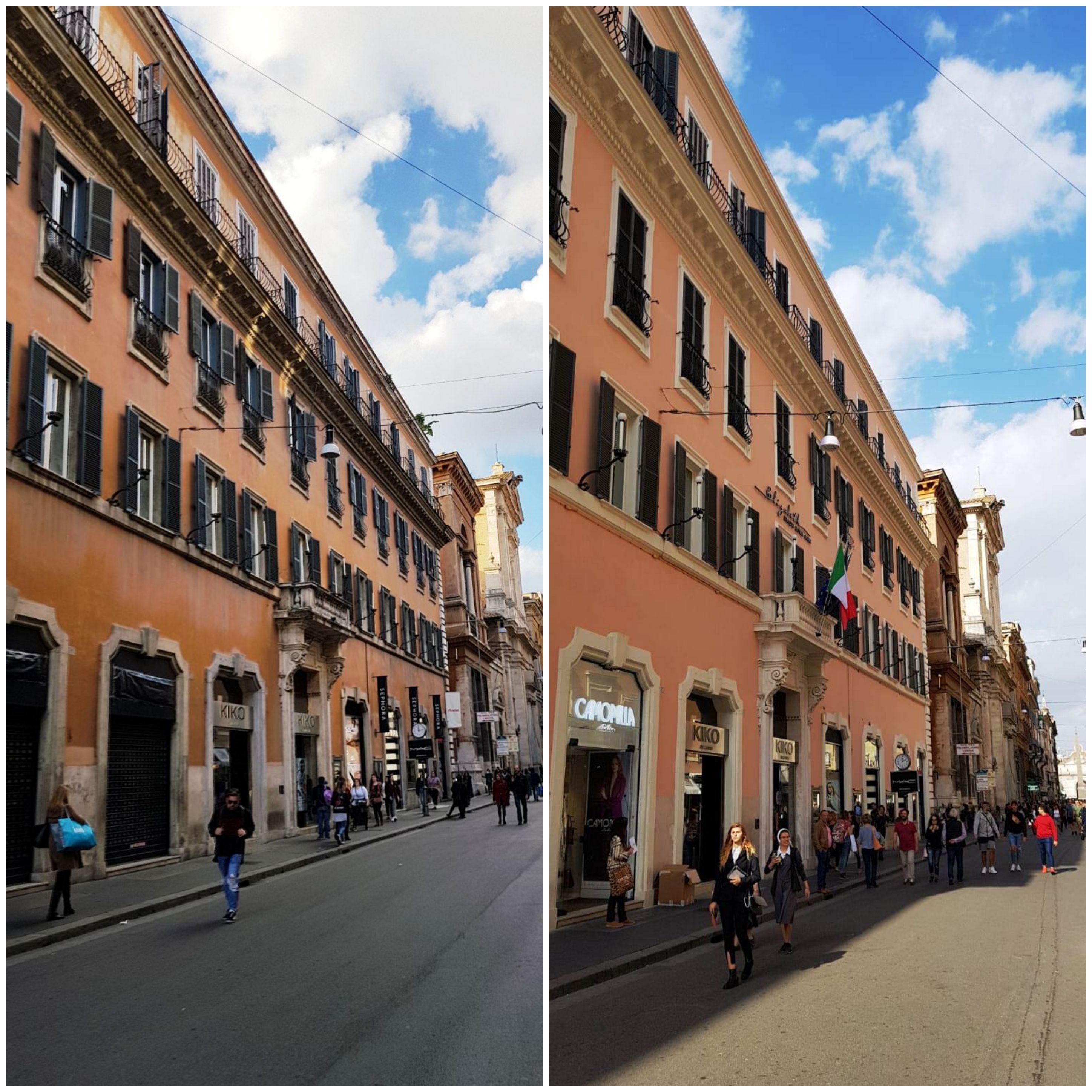 ante e post operam foto 5